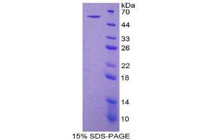 Image no. 1 for Ectonucleoside Triphosphate diphosphohydrolase 1 (ENTPD1) (AA 213-452) protein (His tag,GST tag) (ABIN1879474)