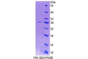 Image no. 1 for Cathepsin O (CTSO) (AA 111-317) protein (His tag) (ABIN6239532)