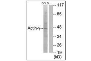 Image no. 3 for anti-Actin, gamma 2, Smooth Muscle, Enteric (ACTG2) (N-Term) antibody (ABIN615858)