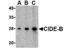 Image no. 3 for anti-Cell Death-Inducing DFFA-Like Effector B (CIDEB) (C-Term) antibody (ABIN499631)
