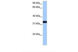 Image no. 1 for anti-Lactate Dehydrogenase C (LDHC) (AA 91-140) antibody (ABIN6738863)