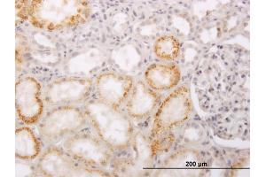 Immunoperoxidase of monoclonal antibody to PHACS on formalin-fixed paraffin-embedded human kidney.