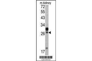 Image no. 1 for anti-Homeobox A5 (HOXA5) (AA 196-223), (C-Term) antibody (ABIN390648)