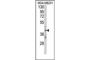 Image no. 3 for anti-Killer Cell Immunoglobulin-Like Receptor, Two Domains, Long Cytoplasmic Tail, 4 (KIR2DL4) (AA 302-332), (C-Term) antibody (ABIN951198)