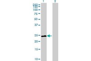 Image no. 1 for anti-DnaJ (Hsp40) Homolog, Subfamily B, Member 8 (DNAJB8) (AA 1-232) antibody (ABIN531160)