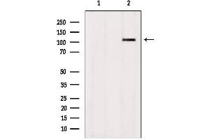 Image no. 1 for anti-Zinc Finger Protein 295 (ZNF295) (N-Term) antibody (ABIN6266124)
