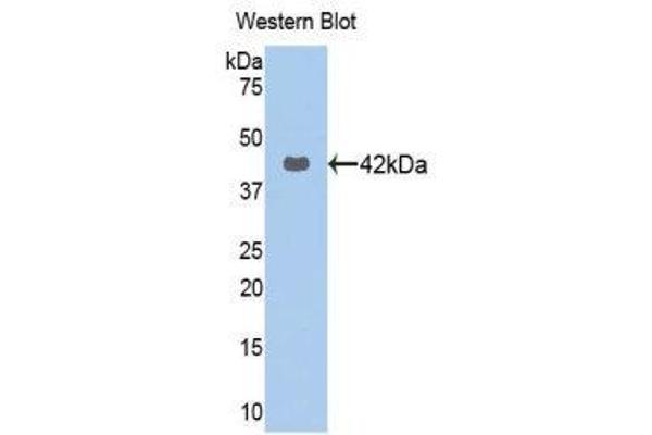KRT16 Antikörper  (AA 117-419)