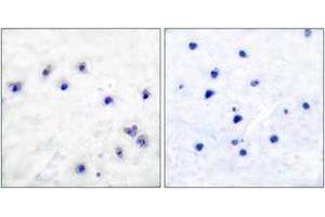 Immunohistochemistry analysis of paraffin-embedded human brain, using Tyrosine Hydroxylase (Phospho-Ser19) Antibody.