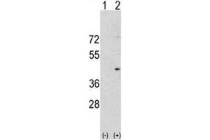 Image no. 3 for anti-Aurora Kinase A (AURKA) (AA 364-392) antibody (ABIN3030073)