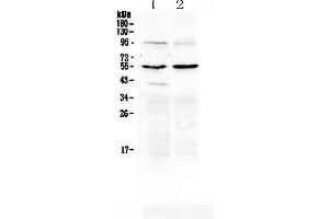 Image no. 2 for anti-Matrix Metallopeptidase 10 (Stromelysin 2) (MMP10) (AA 239-476) antibody (ABIN5519038)