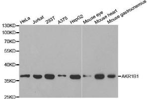 Image no. 1 for anti-Aldo-Keto Reductase Family 1, Member B1 (Aldose Reductase) (AKR1B1) antibody (ABIN3022391)