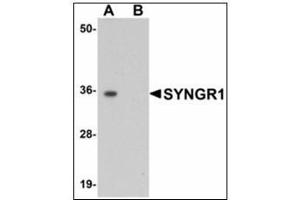 Image no. 2 for anti-Synaptogyrin 1 (SYNGR1) antibody (ABIN783231)