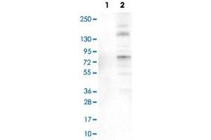 Image no. 2 for anti-Acyl-CoA Synthetase Long-Chain Family Member 5 (ACSL5) antibody (ABIN5649761)