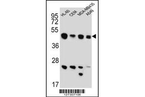 Western Blotting (WB) image for anti-Bridging Integrator 2 (BIN2) antibody (ABIN2159529)