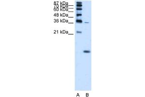 Image no. 2 for anti-Hemoglobin, zeta (HBZ) (N-Term) antibody (ABIN2775308)