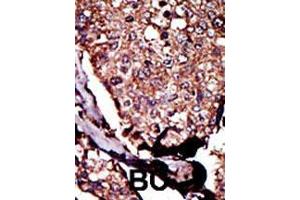 Image no. 3 for anti-Diacylglycerol Kinase, beta 90kDa (DGKB) (AA 773-804), (C-Term) antibody (ABIN392727)