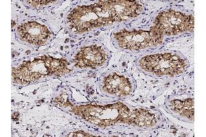 Image no. 1 for anti-P53 and DNA-Damage Regulated 1 (PDRG1) (AA 1-133) antibody (ABIN2692773)