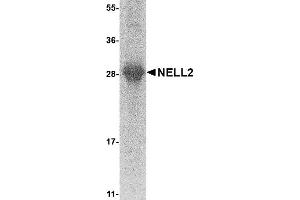 Image no. 1 for NEL-Like 2 (Chicken) (NELL2) (AA 22-238) protein (His tag) (ABIN2468886)