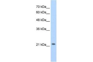 Image no. 1 for anti-Distal-Less Homeobox Protein 2 (DLX2) antibody (ABIN2460395)