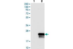Image no. 2 for anti-Organic Solute Transporter beta (OSTBETA) antibody (ABIN5588256)