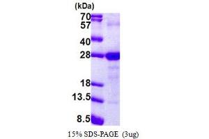 Image no. 1 for Lymphocyte Antigen 6 Complex, Locus G6F (LY6G6F) (AA 17-235) protein (His tag) (ABIN5853149)