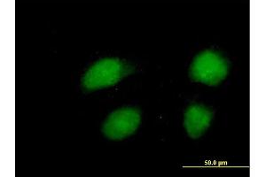Image no. 2 for anti-Pogo Transposable Element with KRAB Domain (POGK) (AA 1-609) antibody (ABIN528255)