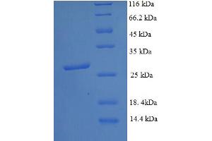 Image no. 1 for DNA (Cytosine-5-)-Methyltransferase 3 alpha (DNMT3A) (AA 680-902), (partial) protein (His tag) (ABIN5712013)