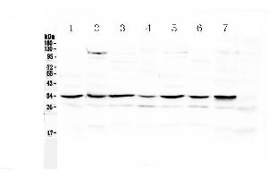 Image no. 1 for anti-Uncoupling Protein 2 (Mitochondrial, Proton Carrier) (UCP2) (AA 134-170), (Middle Region) antibody (ABIN5518965)
