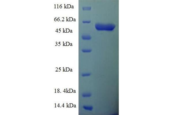 SCRIB Protein (AA 33-443) (His-SUMO Tag)