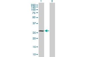 Image no. 1 for anti-TAF9B RNA Polymerase II, TATA Box Binding Protein (TBP)-Associated Factor, 31kDa (TAF9B) (AA 1-251) antibody (ABIN526835)