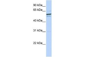 Image no. 2 for anti-Osteoactivin (GPNMB) (N-Term) antibody (ABIN2781894)
