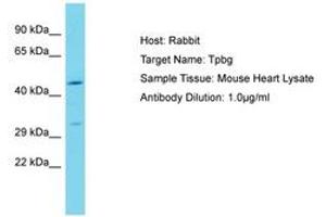 Image no. 1 for anti-Trophoblast Glycoprotein (TPBG) (N-Term) antibody (ABIN6750266)