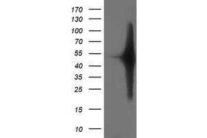 Image no. 2 for anti-SET Domain Containing (Lysine Methyltransferase) 7 (SETD7) antibody (ABIN2731872)