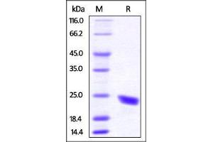 Image no. 2 for CD40 Ligand (CD40LG) (AA 115-260) (Active) protein (His tag) (ABIN4949165)
