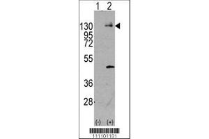 Image no. 1 for anti-Platelet-Derived Growth Factor Receptor, alpha Polypeptide (PDGFRA) (AA 698-727) antibody (ABIN392024)