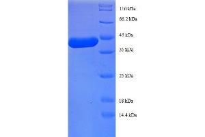 Image no. 1 for Ribosomal Protein L27 (RPL27) (AA 2-136), (full length) protein (GST tag) (ABIN1607976)