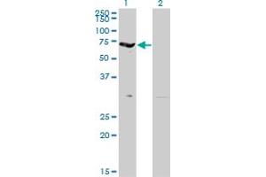 Image no. 1 for anti-erythrocyte Membrane Protein Band 4.2 (EPB42) (AA 623-721) antibody (ABIN515323)