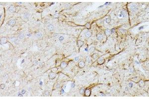 Immunohistochemistry of paraffin-embedded Rat brain using TBCA Polyclonal Antibody at dilution of 1:100 (40x lens).