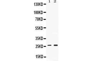 Image no. 1 for anti-Proteasome Subunit alpha 2 (PSMA2) (AA 82-123), (Middle Region) antibody (ABIN4886705)