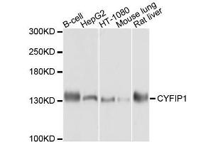 Image no. 1 for anti-Cytoplasmic FMR1 Interacting Protein 1 (CYFIP1) antibody (ABIN6139306)
