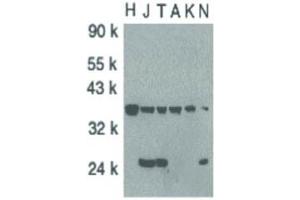 Image no. 3 for anti-CASP8 and FADD-Like Apoptosis Regulator (CFLAR) (C-Term) antibody (ABIN6655307)