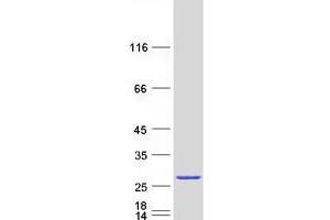Image no. 1 for ADP Ribosylation Factor Like GTPase 6 (ARL6) (Transcript Variant 2) protein (Myc-DYKDDDDK Tag) (ABIN2714915)