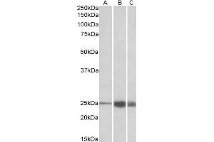 Image no. 1 for anti-Fast Skeletal Troponin I (TNNI2) (AA 83-95) antibody (ABIN1590144)