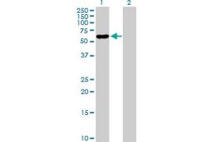 anti-Pancreatic Lipase-Related Protein 2 (PNLIPRP2) (AA 1-469) antibody