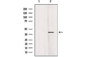 RASSF1 anticorps  (Internal Region)
