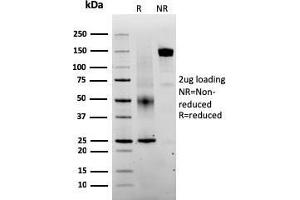 Image no. 1 for anti-SERPINE1 mRNA Binding Protein 1 (SERBP1) (AA 3-139) antibody (ABIN6939487)