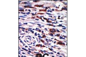 Image no. 3 for anti-Protein Kinase C, eta (PRKCH) (AA 210-239), (N-Term) antibody (ABIN5531850)