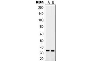 Image no. 2 for anti-Prostaglandin Reductase 2 (PTGR2) (Center) antibody (ABIN2706890)