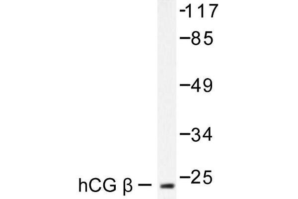 anti-Chorionic Gonadotropin (hCG) antibody