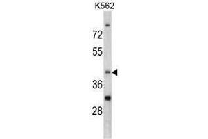 Image no. 1 for anti-CCR4 Carbon Catabolite Repression 4-Like (CCRN4L) (C-Term) antibody (ABIN452826)